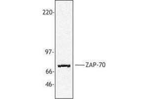Western Blotting (WB) image for anti-zeta-Chain (TCR) Associated Protein Kinase 70kDa (ZAP70) antibody (ABIN2665463) (ZAP70 anticorps)