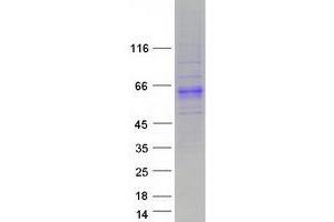Validation with Western Blot (ACPL2 Protein (Transcript Variant 2) (Myc-DYKDDDDK Tag))