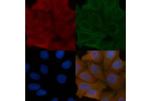 TST Mouse Monoclonal Antibody staining Hela cells by IF/ICC. (TST anticorps)