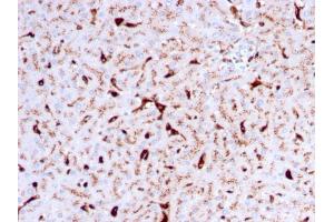 Formalin-fixed, paraffin-embedded human Liver stained with Cathepsin K Mouse Monoclonal Antibody (CTSK/2792). (Cathepsin K anticorps  (AA 163-274))