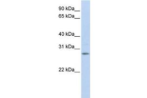IGFBP4 antibody used at 1 ug/ml to detect target protein. (IGFBP4 anticorps  (Middle Region))