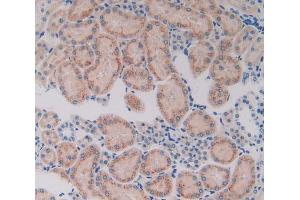 Used in DAB staining on fromalin fixed paraffin- embedded kidney tissue
