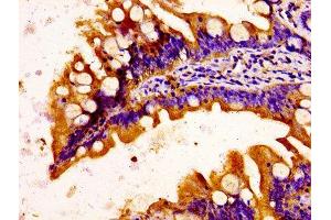 IHC image of ABIN7148345 diluted at 1:100 and staining in paraffin-embedded human small intestine tissue performed on a Leica BondTM system.
