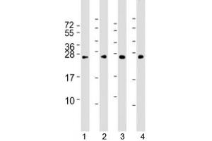 Western blot testing of human 1) HeLa, 2) HepG2, 3) Jurkat and 4) mouse NIH3T3 cell lysate with RAB5B antibody at 1:2000. (RAB5B anticorps)