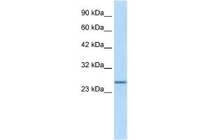 WB Suggested Anti-SOX14 Antibody Titration:  1. (SOX14 anticorps  (N-Term))