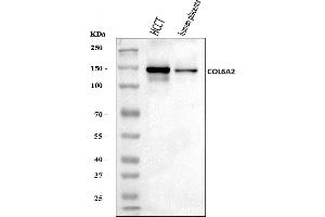 Western blot analysis of Collagen VI/COL6A2 using anti-Collagen VI/COL6A2 antibody (ABIN7601439).