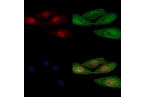 ABIN6256959 and ABIN6274926 staining  cells by IF/ICC.