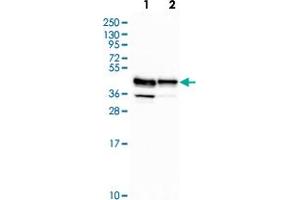 Western blot analysis of Lane 1: Human cell line RT-4 Lane 2: Human cell line U-251MG with RCN3 polyclonal antibody  at 1:500-1:1000 dilution. (RCN3 anticorps)