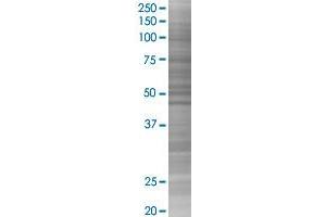DSG1 transfected lysate. (DSG1 293T Cell Transient Overexpression Lysate(Denatured))