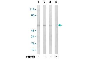 Western blot analysis of extracts from COLO cells (Lane 1), HUVEC cells (Lane 2 and lane 4) and MCF-7 cells (Lane 3), using GRB14 polyclonal antibody . (GRB14 anticorps)