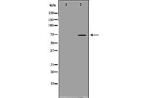 Western blot analysis of extracts of PC-3, using SCNN1B antibody.