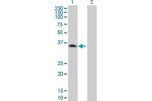 Western Blot analysis of ZNF187 expression in transfected 293T cell line by ZNF187 MaxPab polyclonal antibody. (ZNF187 anticorps  (AA 1-325))