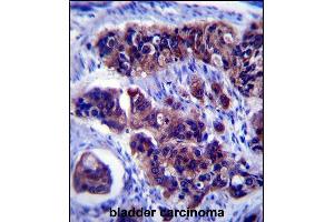 anti-Zinc Finger, DHHC-Type Containing 24 (ZDHHC24) (AA 214-241), (C-Term) antibody