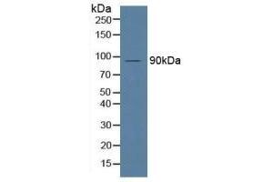 Detection of MPG1 in Human Serum using Polyclonal Antibody to Macrophage Expressed Gene 1 Protein (MPG1) (MPEG1 anticorps  (AA 313-580))