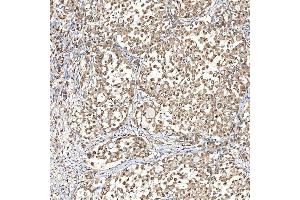IHC analysis of Syntenin 2/SDCBP2 using anti-Syntenin 2/SDCBP2 antibody (ABIN7600017).