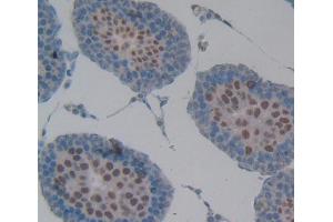 Used in DAB staining on fromalin fixed paraffin- embedded testis tissue (RNASEH2A anticorps  (AA 1-301))