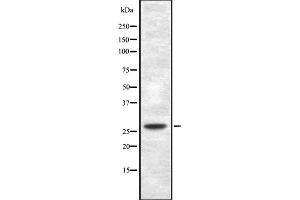 Western blot analysis of TP53INP1 using HepG2 whole cell lysates (TP53INP1 anticorps  (Internal Region))