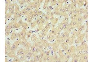 Immunohistochemistry of paraffin-embedded human liver tissue using ABIN7168635 at dilution of 1:100