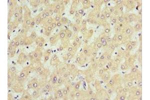 Immunohistochemistry of paraffin-embedded human liver tissue using ABIN7168635 at dilution of 1:100 (Sclerostin anticorps  (AA 24-213))