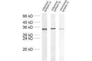 dilution: 1 : 1000, sample: crude synaptosomal fraction of rat brain (P2) (Syntaxin 1B anticorps  (AA 171-187))