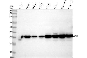 Western blot analysis of DDAH1 using anti-DDAH1 antibody (ABIN4886560). (DDAH1 anticorps  (C-Term))