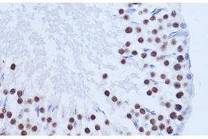 Immunohistochemistry of paraffin-embedded Rat testis using MATR3 Polyclonal Antibody at dilution of 1:100 (40x lens). (MATR3 anticorps)