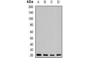 Western blot analysis of NAT5 expression in MCF7 (A), mouse kidney (B), mouse heart (C), rat lung (D) whole cell lysates. (NAT5 anticorps)