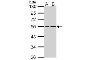 WB Image Sample (30 ug of whole cell lysate) A: A431 , B: H1299 10% SDS PAGE antibody diluted at 1:5000 (RUVBL2 anticorps  (C-Term))