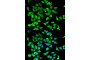 Immunofluorescence analysis of HeLa cell using NFATC3 antibody. (NFATC3 anticorps)