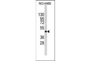 Image no. 1 for anti-Integrin-Linked Kinase (ILK) (Thr173) antibody (ABIN359883) (ILK anticorps  (Thr173))