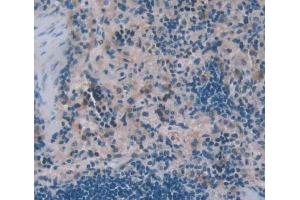 Used in DAB staining on fromalin fixed paraffin- embedded Kidney tissue