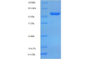 SDS-PAGE (SDS) image for Oxidoreductase NAD-Binding Domain Containing 1 (OXNAD1) (AA 18-312) protein (His-SUMO Tag) (ABIN5711583)