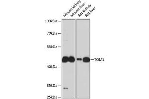 Western blot analysis of extracts of various cell lines, using TOM1 antibody (ABIN6128832, ABIN6149379, ABIN6149380 and ABIN6224955) at 1:3000 dilution. (TOM1 anticorps  (AA 314-493))