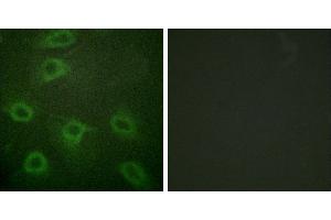 P-peptide - +Immunofluorescence analysis of HeLa cells, using BAD (Phospho-Ser134) antibody.