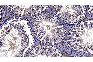 Detection of NFKB3 in Mouse Testis Tissue using Polyclonal Antibody to Transcription Factor P65 (NFKB3)