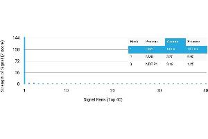 Protein Array (PAr) image for anti-Choline O-Acetyltransferase (CHAT) antibody (ABIN7456285)