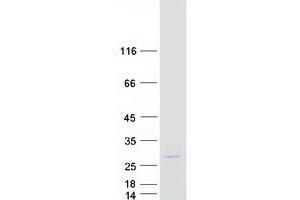 Validation with Western Blot