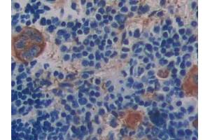 DAB staining on IHC-P; Samples: Mouse Spleen Tissue (Integrin beta 3 anticorps  (AA 134-376))