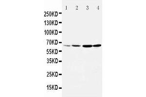 Anti-Dopamine Receptor D1 antibody, Western blotting Lane 1: Rat Testis Tissue Lysate Lane 2: Rat Brain Tissue Lysate Lane 3: U87 Cell Lysate Lane 4: HELA Cell Lysate