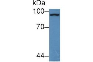 Rabbit Detection antibody from the kit in WB with Positive Control: Sample Mouse Cerebrum lysate.