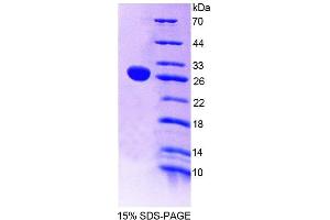 SDS-PAGE (SDS) image for 5'-Nucleotidase, Cytosolic II (NT5C2) (AA 1-212) protein (His tag) (ABIN6239519)