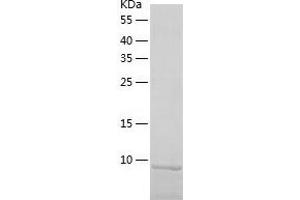 Western Blotting (WB) image for Catenin, beta Interacting Protein 1 (CTNNBIP1) (AA 1-81) protein (His-IF2DI Tag) (ABIN7122179)