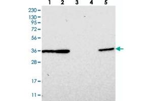Western blot analysis of Lane 1: RT-4, Lane 2: U-251 MG, Lane 3: Human Plasma, Lane 4: Liver, Lane 5: Tonsil with DNAJB14 polyclonal antibody  at 1:250-1:500 dilution. (DNAJB14 anticorps)
