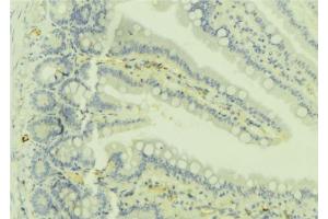 ABIN6279736 at 1/100 staining Mouse colon tissue by IHC-P. (RAB32 anticorps  (C-Term))