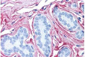 Human Breast (formalin-fixed, paraffin-embedded) stained with Collagen VI antibody ABIN364508 at 2. (COL6 anticorps)