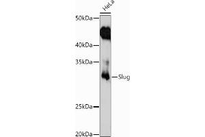 Western blot analysis of extracts of HeLa cells, using Slug antibody (ABIN3021317, ABIN3021318, ABIN3021319 and ABIN6214866) at 1:1000 dilution. (SLUG anticorps  (AA 89-268))