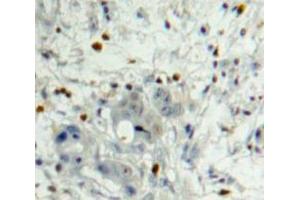Used in DAB staining on fromalin fixed paraffin-embedded Pancreas tissue (PDGFB anticorps  (AA 21-241))