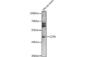 Western blot analysis of extracts of Mouse brain, using CCR9 antibody (ABIN7266312) at 1:1000 dilution. (CCR9 anticorps  (AA 1-100))