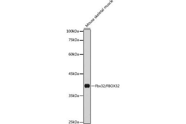 FBXO32 anticorps  (AA 206-355)