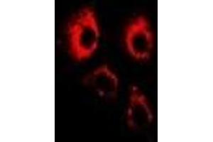 Immunofluorescent analysis of ADAM9 staining in U2OS cells.